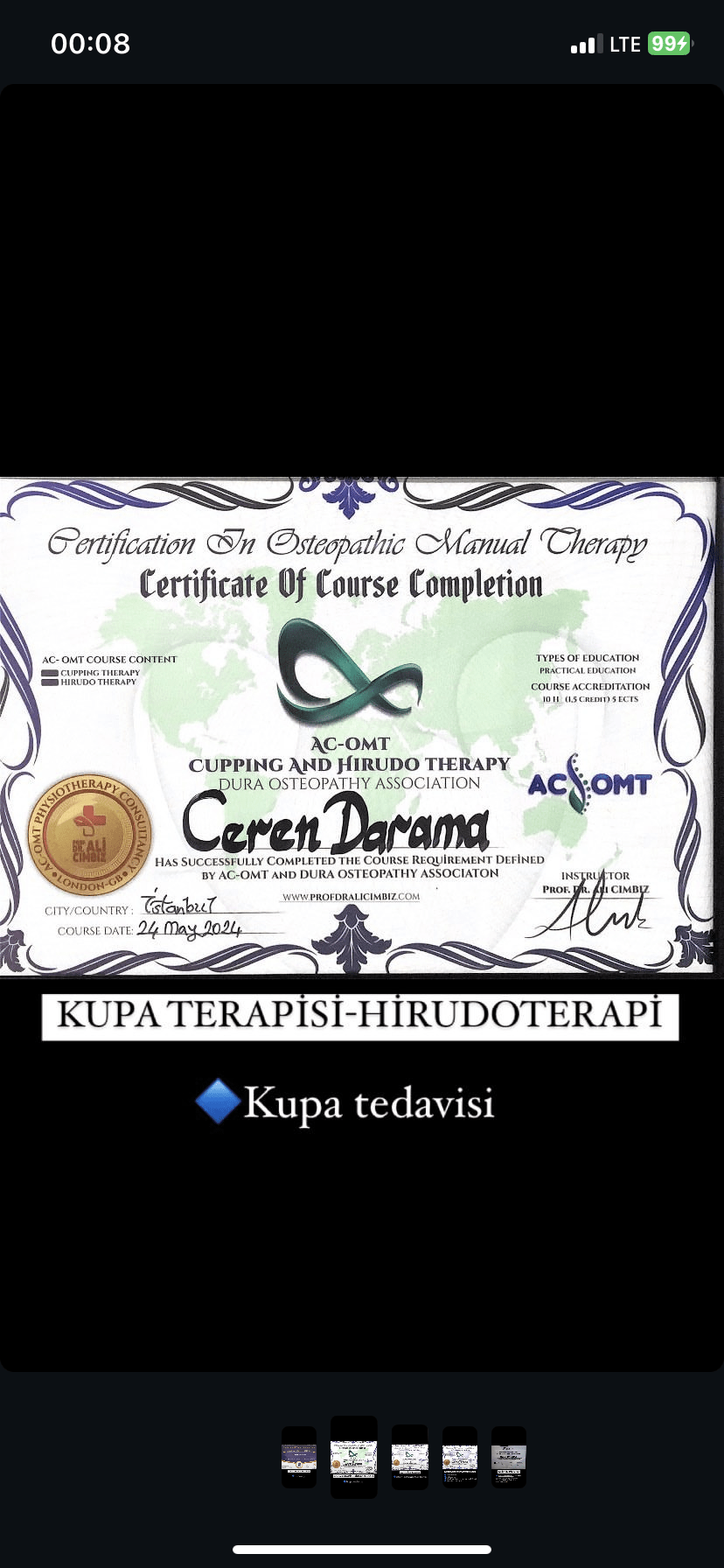 Cupping and hirudo therapy