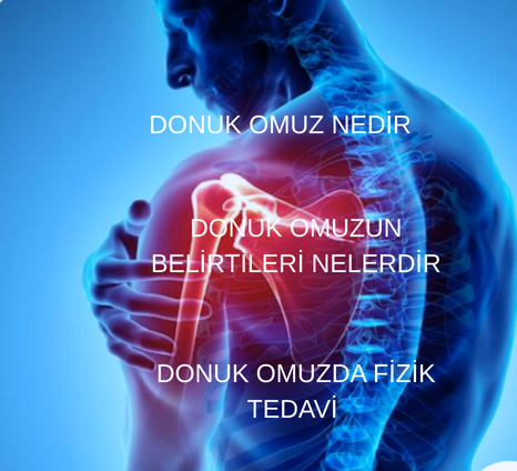 DONUK OMUZ ( ADHEZİV KAPSÜLİT)