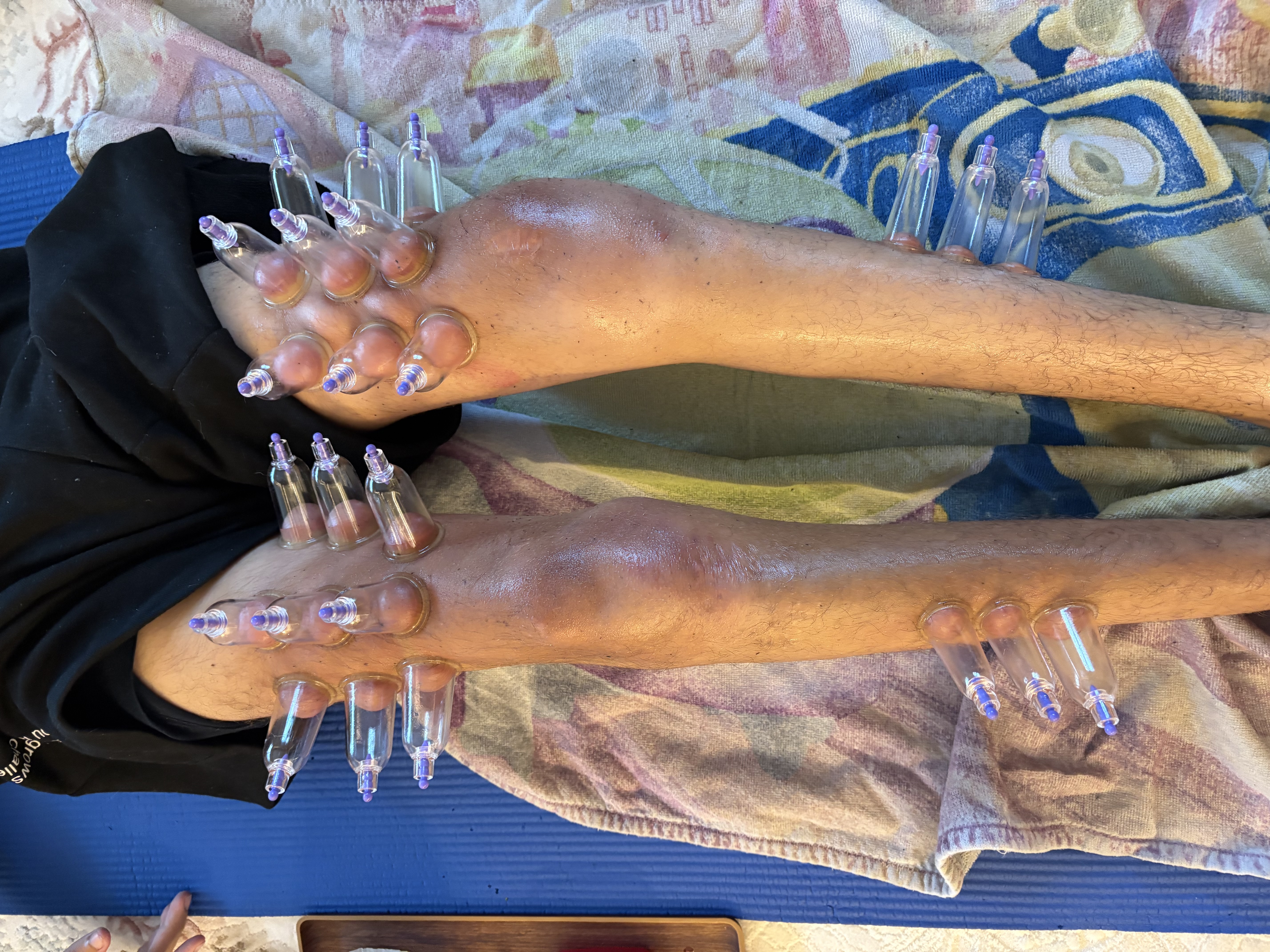 Galeri fotoğrafı 2