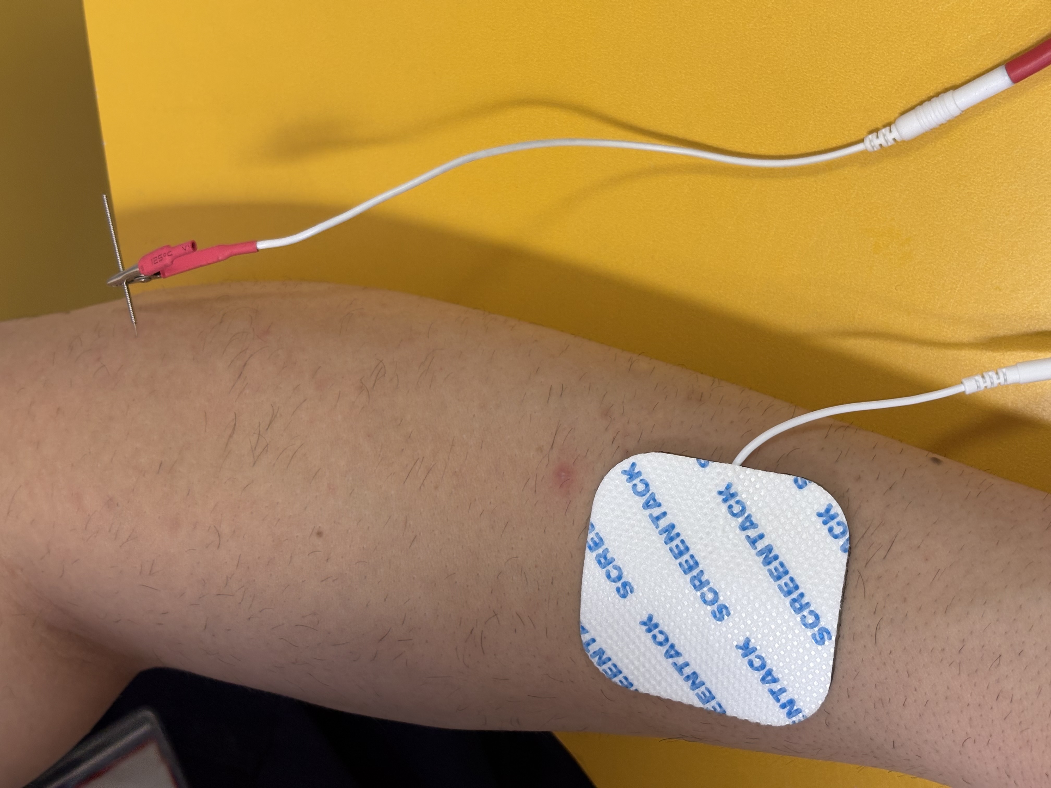 Galeri fotoğrafı 4