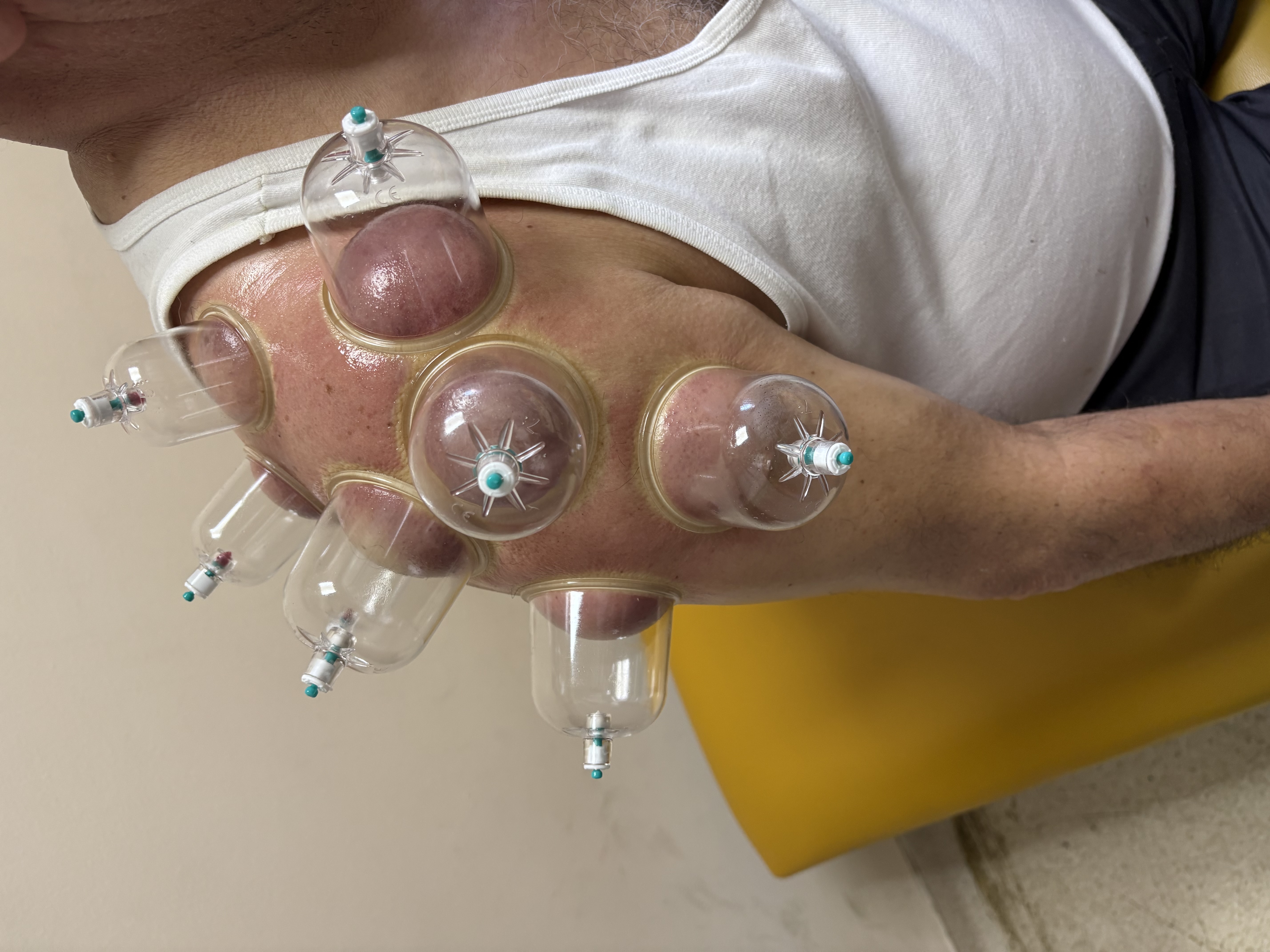 Galeri fotoğrafı 6