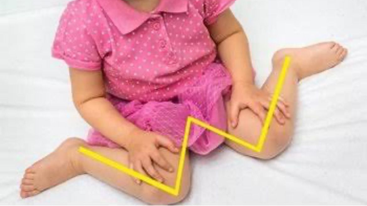 Çocuklar Neden Sakrum Üzerine Oturur?