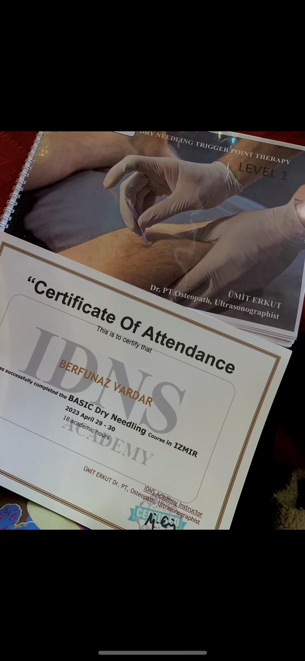 Dry Needling Trigger Point Therapy