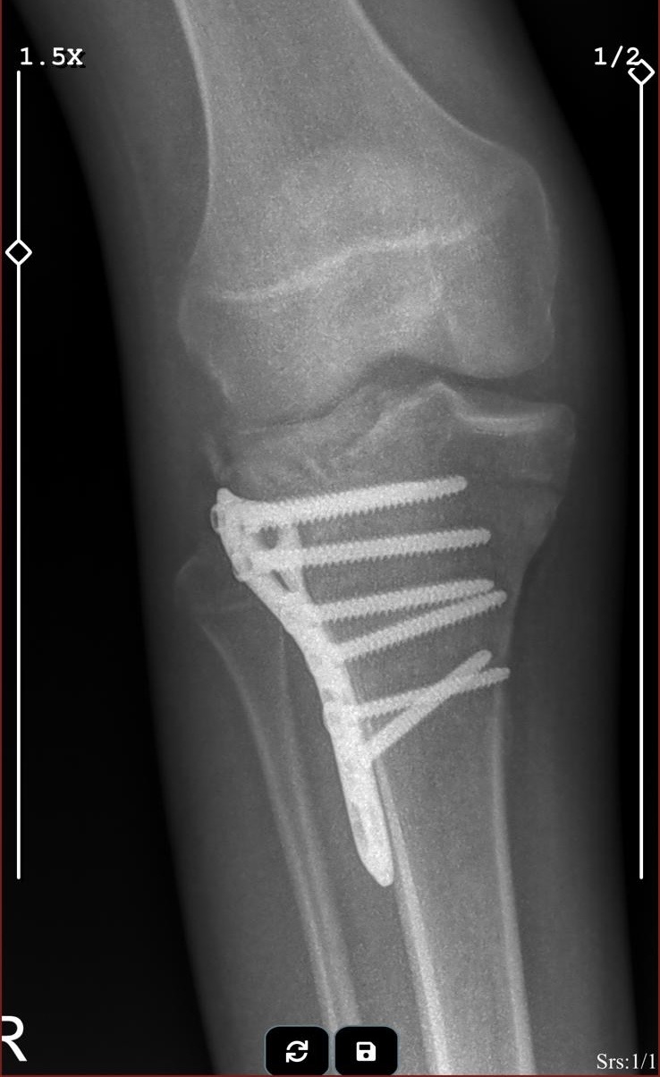 Galeri fotoğrafı 1