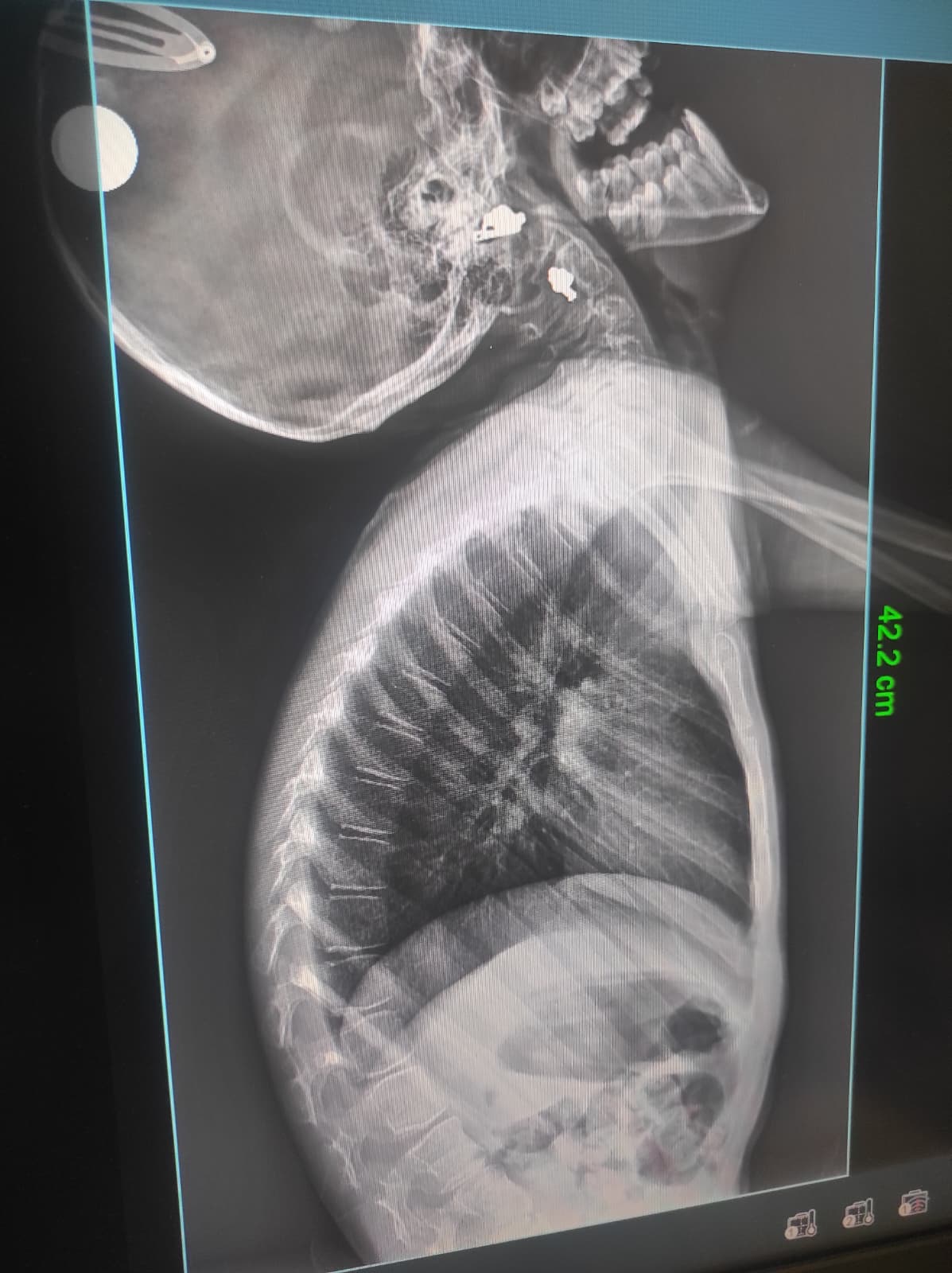 Galeri fotoğrafı 2