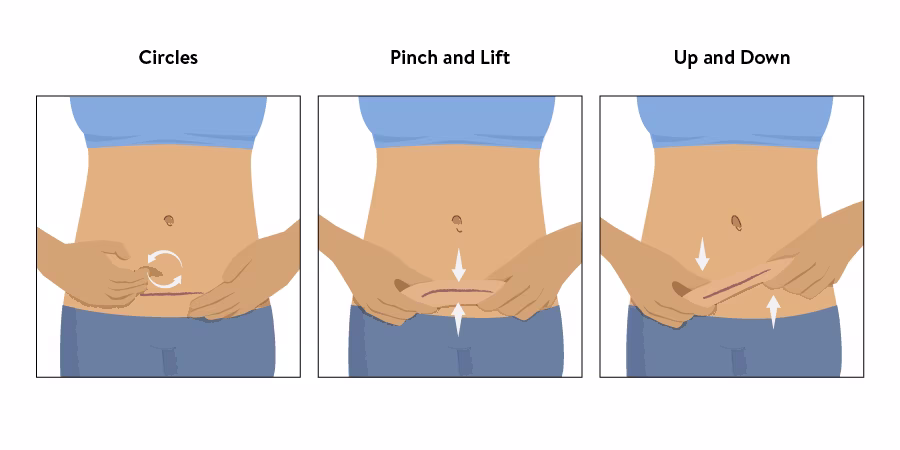 Sezaryen Sonrası İyileşme Rehberi