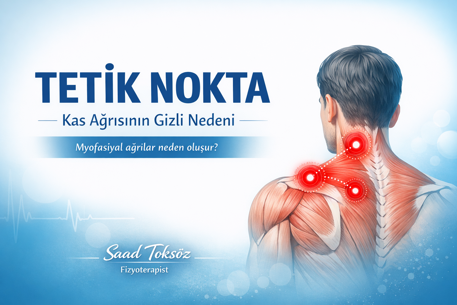 Tetik nokta nedir ?
