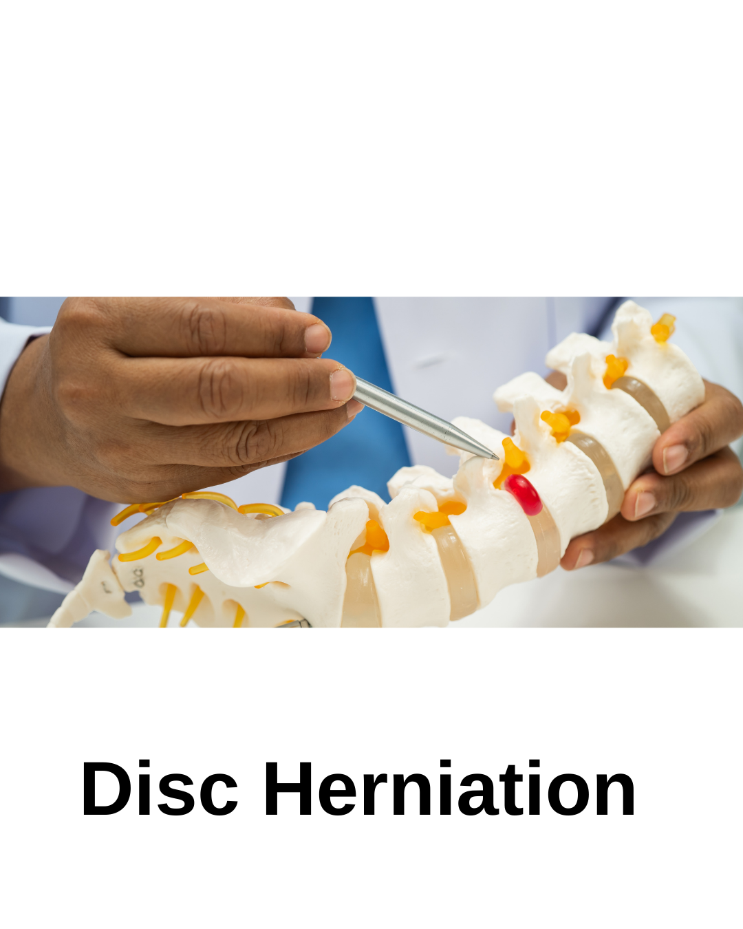 Bel Fıtığında Nelere Dikkat Etmeliyim?