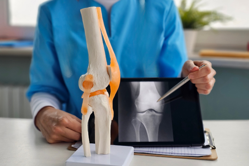 Fizyoterpist Ortopedik Rehabilitasyon açıklıyor