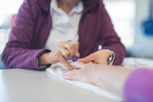 Fizyoterpist El Rehabilitasyonu uyguluyor.