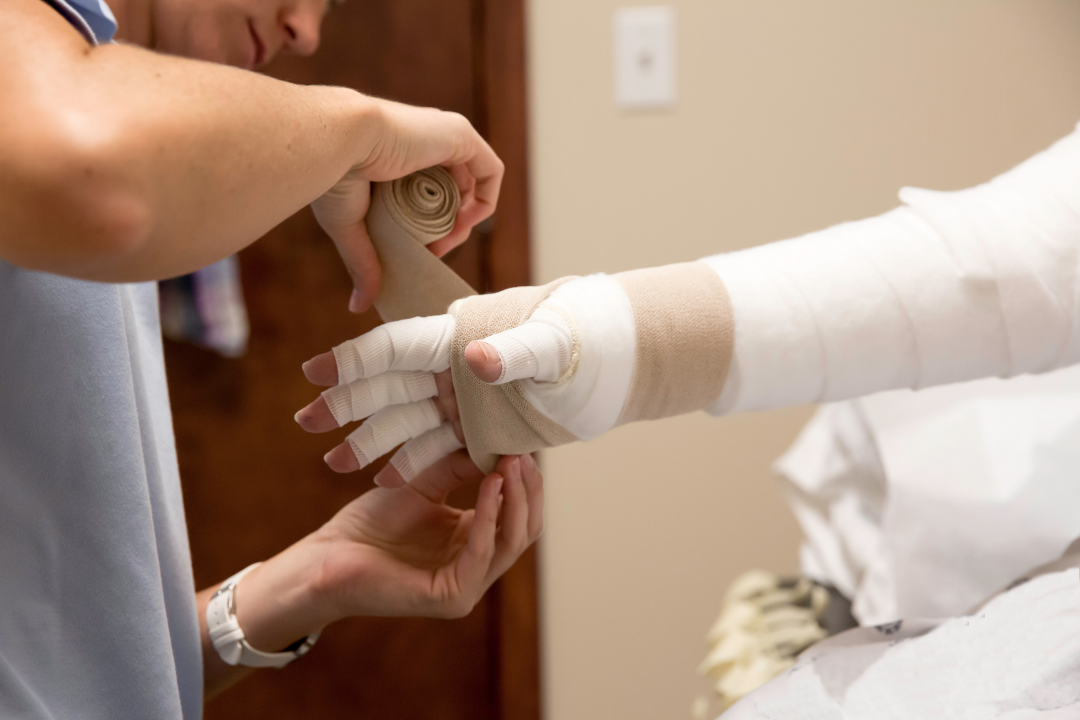 Fizyoterapist lenfödem hastasını tedavi ediyor.