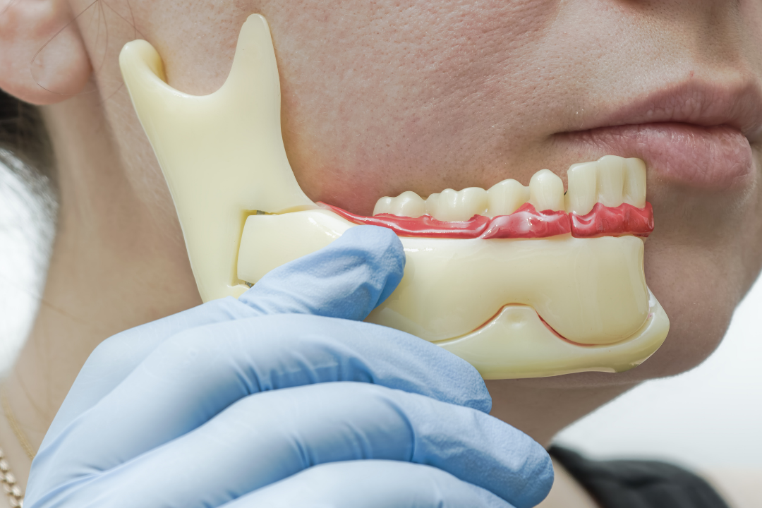 Detaylı Çene Eklemi Yapısı