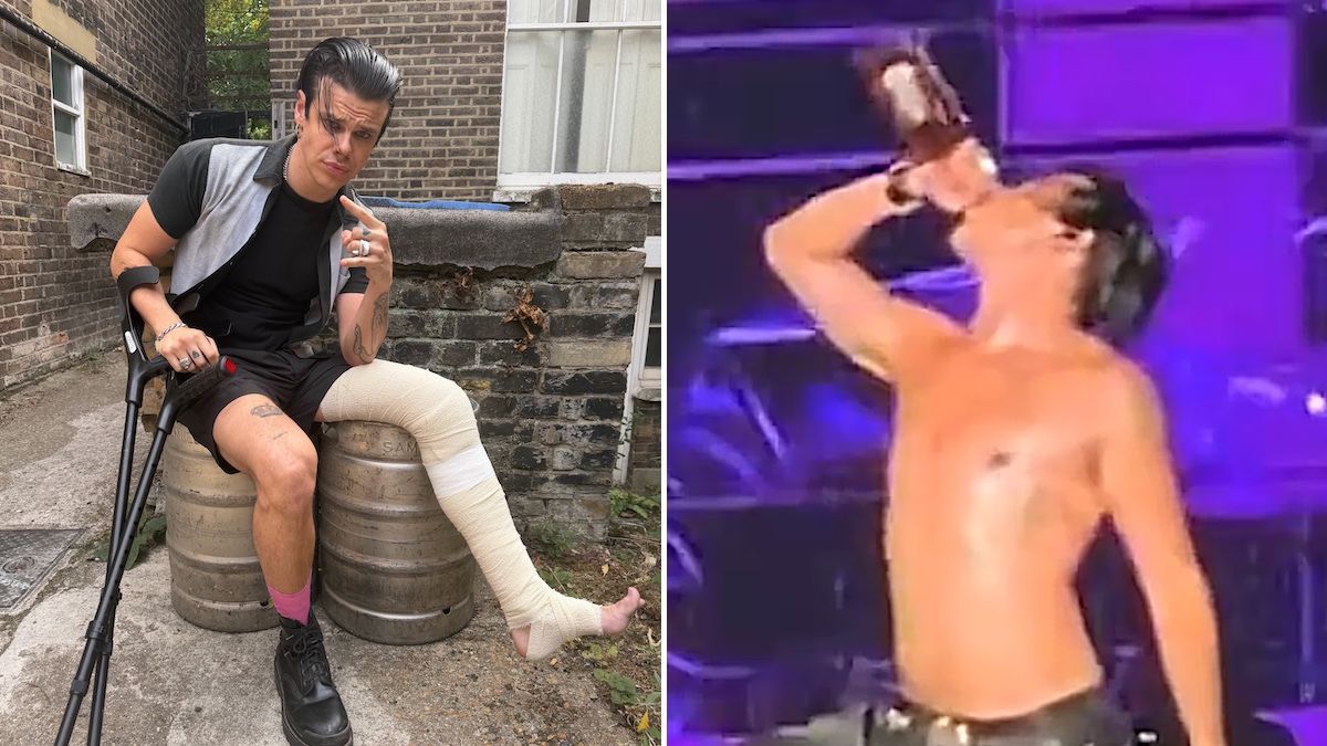 yungblud breaks his leg but keeps the tour going