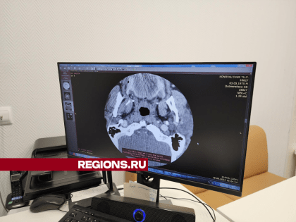Уникальная операция по удалению бляшки из сонной артерии в сосудистом центре