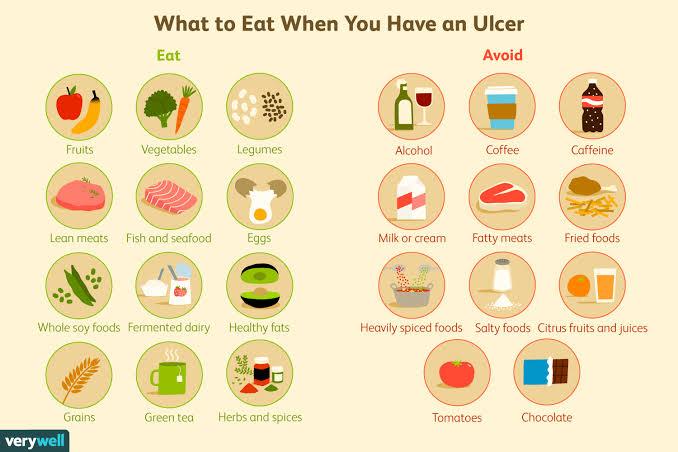 Stomach Ulcer And Nutrition: A Guide For Nigerian Patients