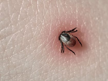 14 клещей зараженных вирусным клещевым энцефалитом выявлено в Хабаровском крае