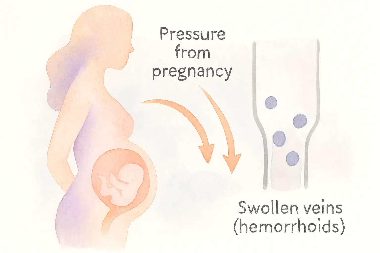 ciri-ciri-ambeien-pada-ibu-hamil