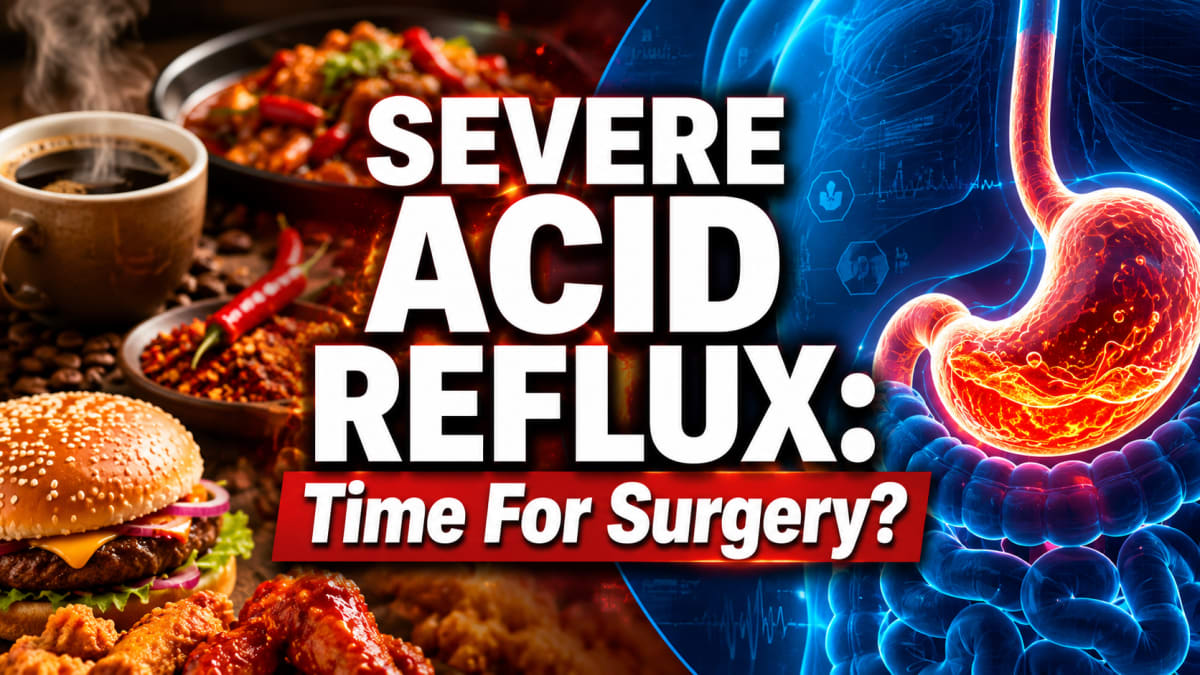 Chronic Acid Reflux: When Is It Time to Consider Surgery?