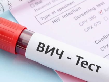 ВИЧ не передаётся от матери к ребенку, отмечают вологодские врачи