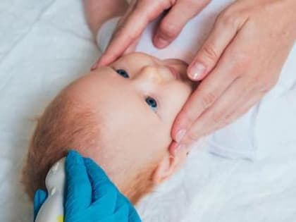 Новорожденных в Вологодской области будут проверять на 36 врожденных заболеваний