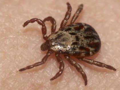 Уже 7528 вологжан стали жертвами клещевых укусов