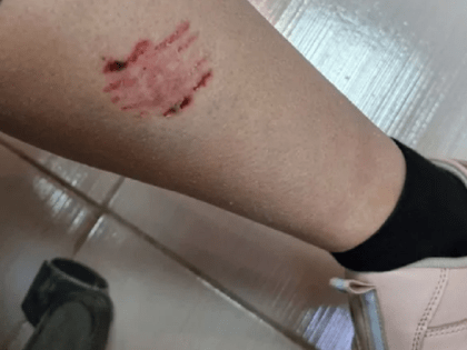 Стая собак набросилась на череповчан в Зашекснинском районе