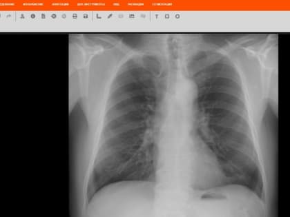 Инновационная система МосМедИИ улучшает диагностику в Вологодской области