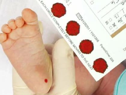 В Вологодской области расшили программу обследования новорождённых