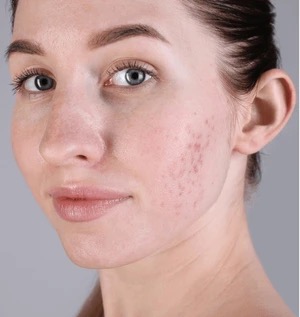 what is the glutathione Can glutathione injections be dangerous? ⚠️, The truth isn’t what social  media tells you…, Glutathione injections are generally safe only under  medical supervision. But risks increase in the wrong main image 1