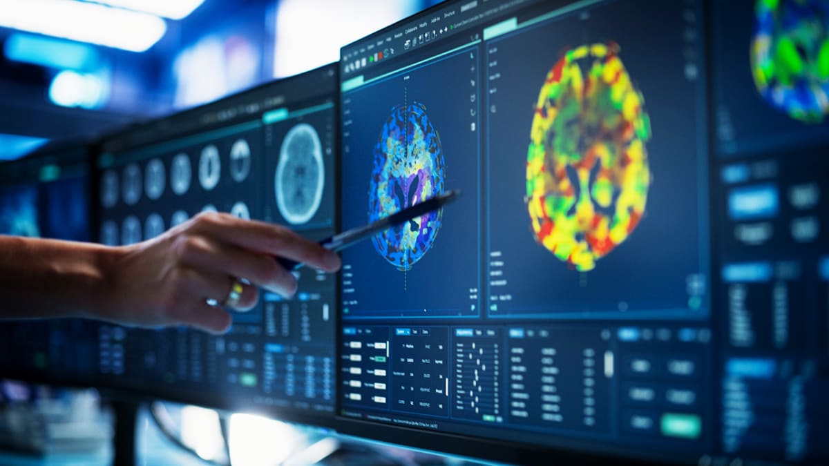 AI Spots Pancreatic Cancer 16 Months Before Doctors Can
