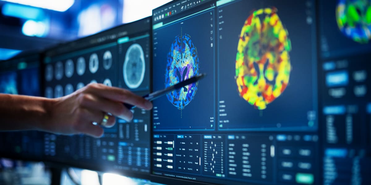 AI Spots Pancreatic Cancer 16 Months Before Doctors Can - Image 2