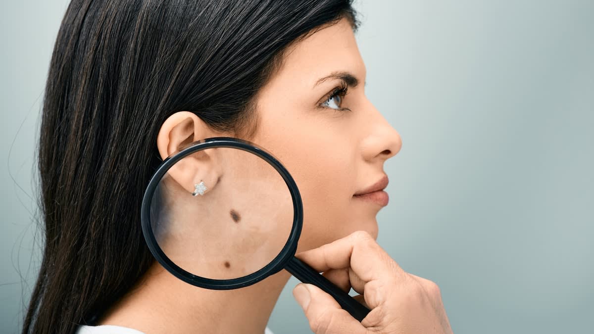 New Cancer Vaccine Cuts Melanoma Risk by Nearly Half - Image 4