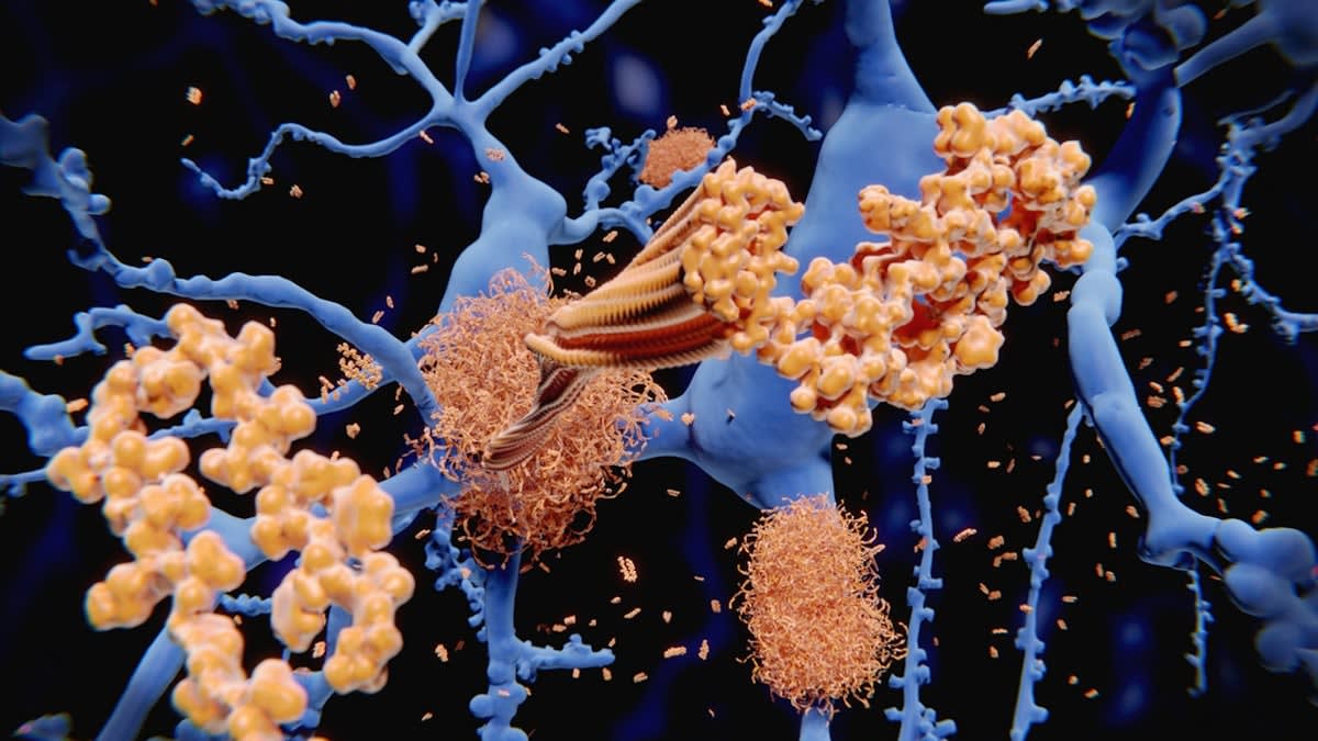 Longevity Gene' Boosts Brain's DNA Repair Against Alzheimer's - Image 2