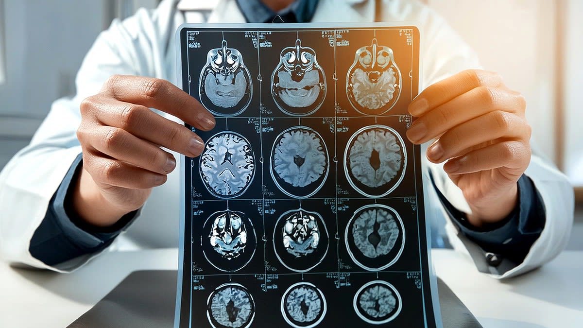 Blood Test Predicts Dementia Risk 25 Years Early - Image 5