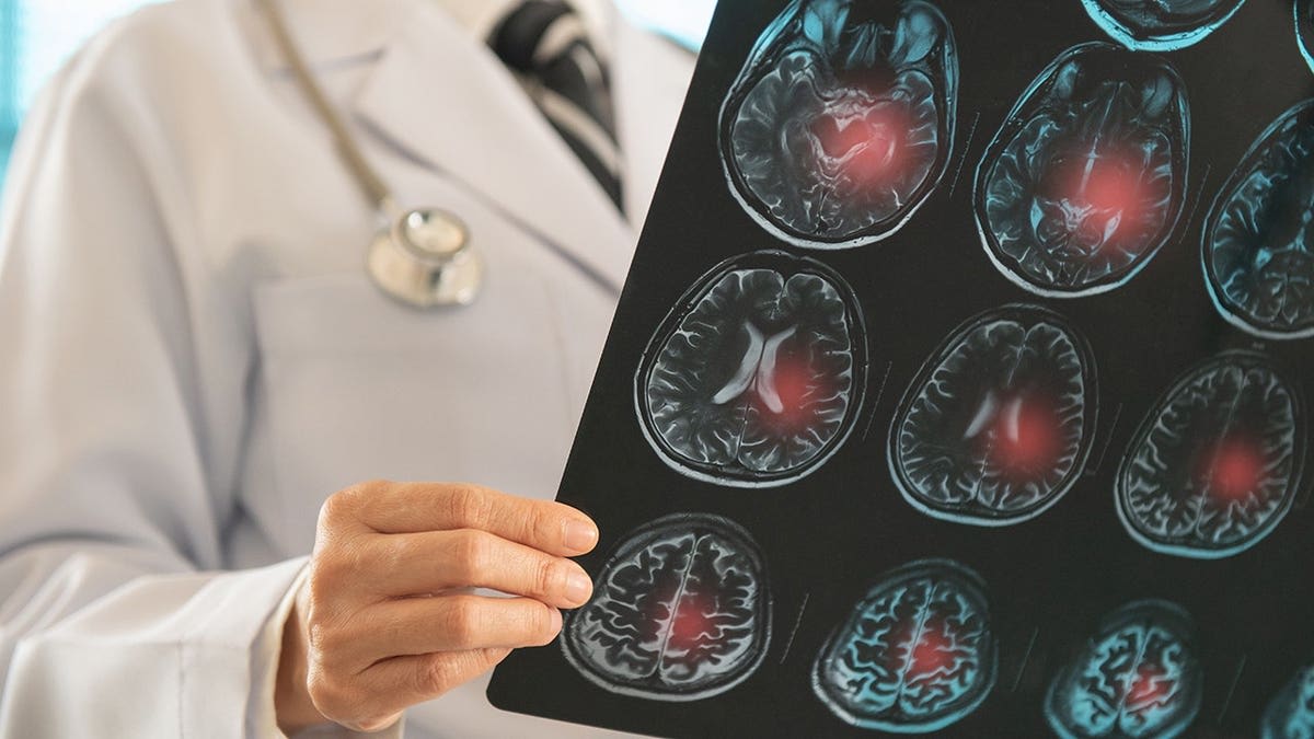 Eating Window of 8 Hours Boosts Brain Health in Older Women - Image 5