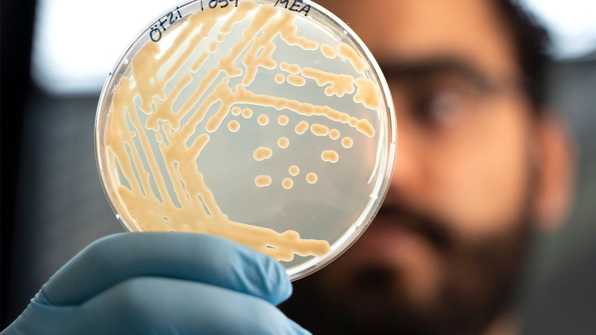 5,300-Year-Old Mummy Still Hosts Living Microbes - Image 5