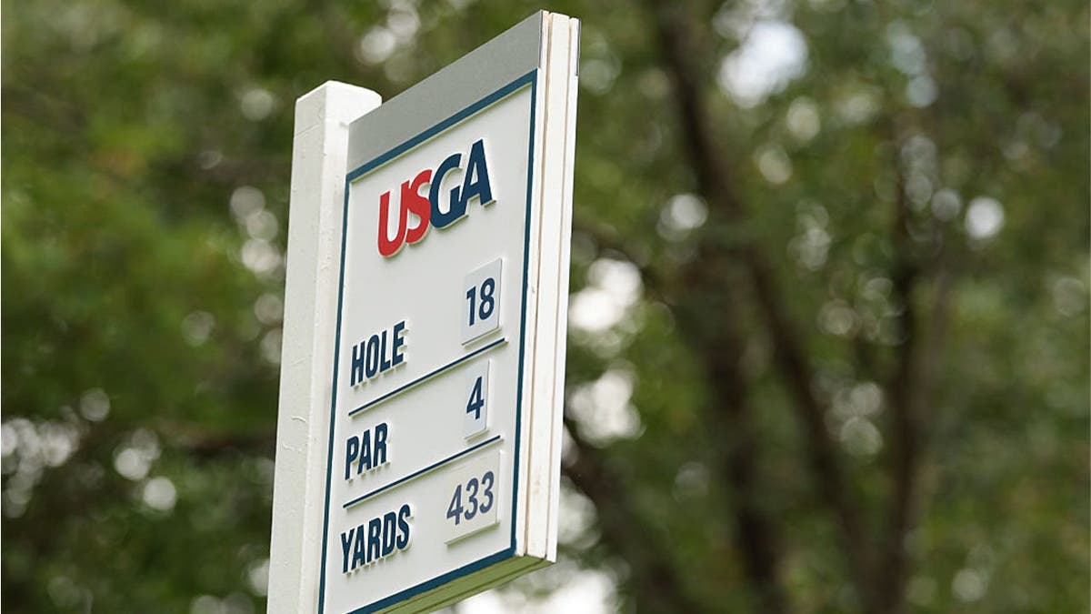 Golfer Aces Hole Right After Truck Confronts Him on Course - Image 3