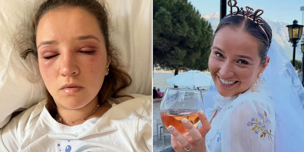 Bride's Eyelash Disaster Saves Others From Same Fate - Image 2