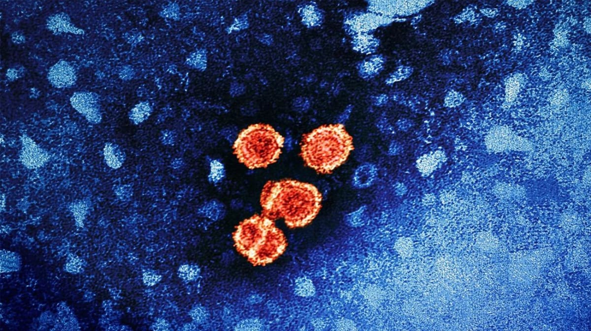 Johns Hopkins Gets $24M to Find Hepatitis B Cure