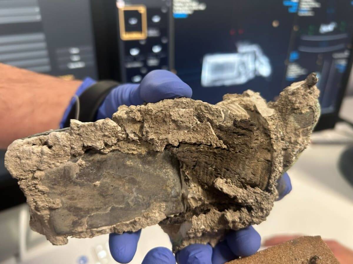 Ancient Doctor's Medical Kit Found in Pompeii Victim's Cast - Image 5