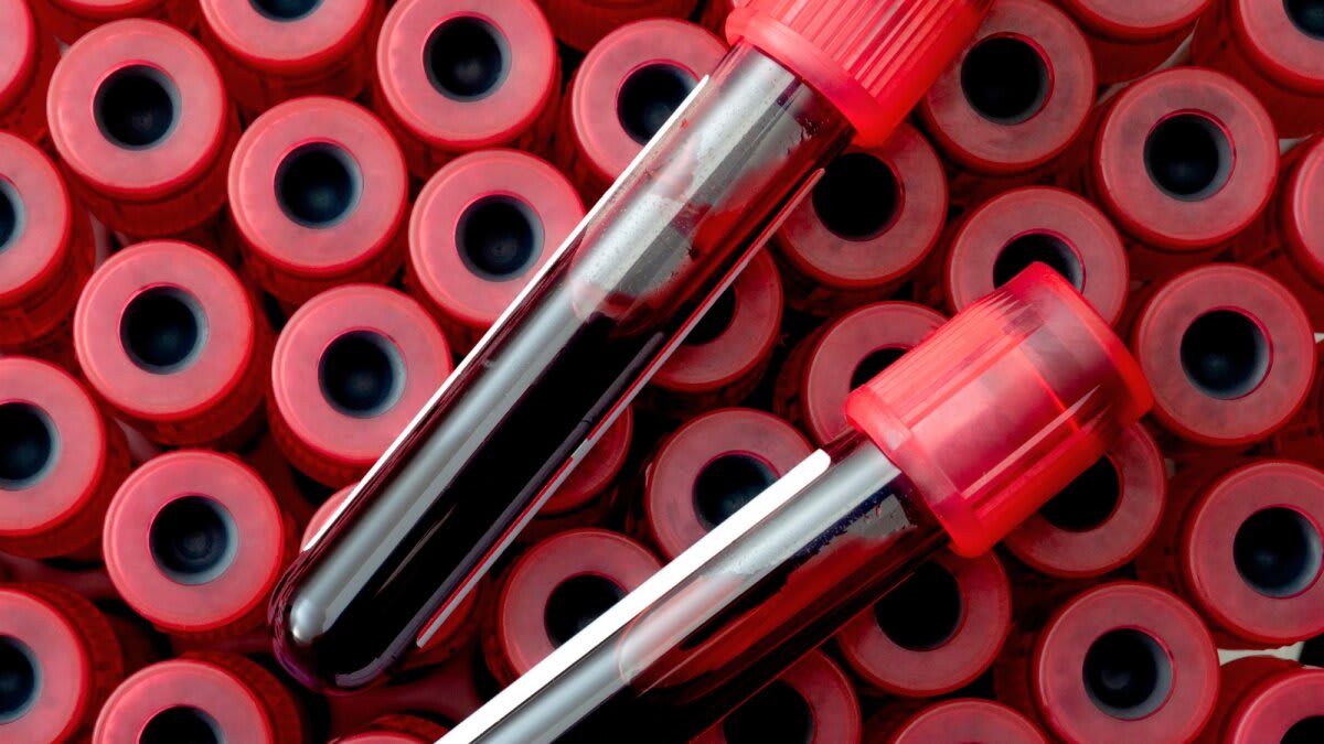 Blood Test May Predict Dementia 20 Years Early - Image 2