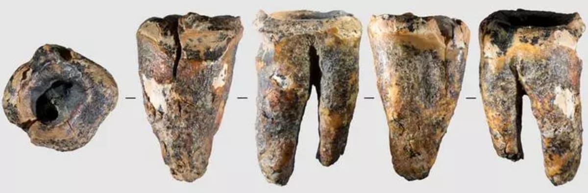 Neanderthals Used Stone Drills 60,000 Years Ago for Dentistry - Image 5
