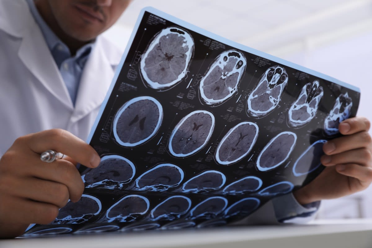 Doctor examining brain MRI scans showing healthy cognitive development and neurological health