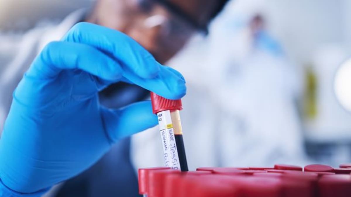 Gene Therapy Cures Pain in 27 of 28 Sickle Cell Patients