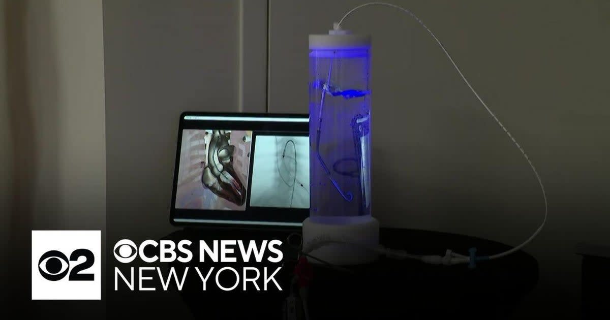 ** Medical heart pump device that saved Long Island cardiac arrest patient's life after 35 minutes