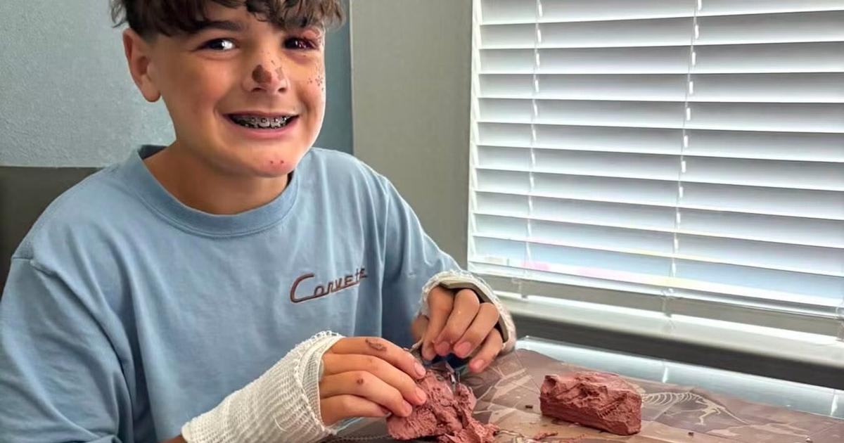 Fourteen-year-old Kohen Pittman recovering at home after serious e-bike accident in Liberty Hill