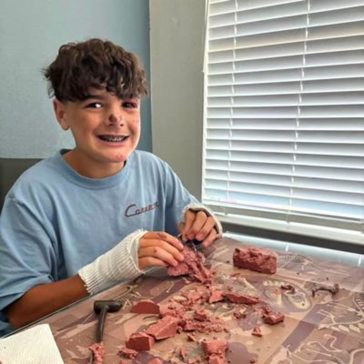 Teen Back at School Weeks After Serious E-Bike Crash - Image 5