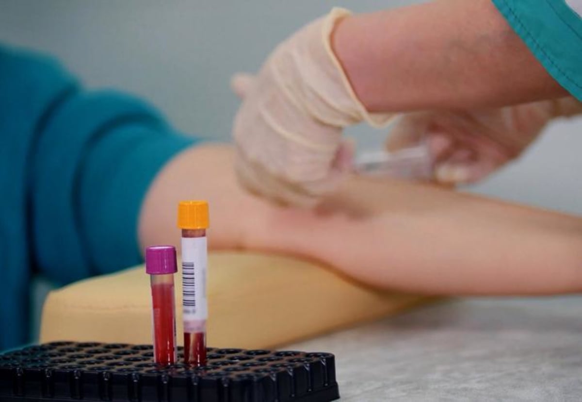 Blood Test Predicts Alzheimer's Up to 10 Years Early - Image 4