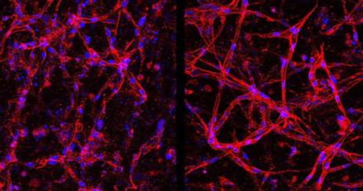 Lab-Grown Cells Restore Vision in Mice with Retinal Disease - Image 2