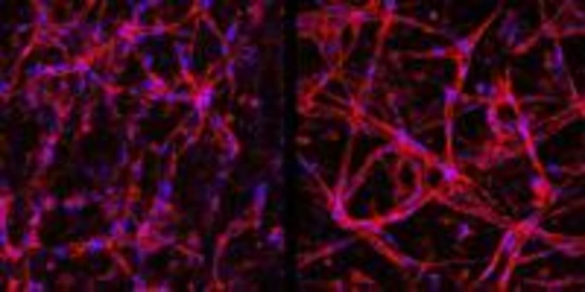 Lab-Grown Cells Restore Vision in Mice with Retinal Disease - Image 5